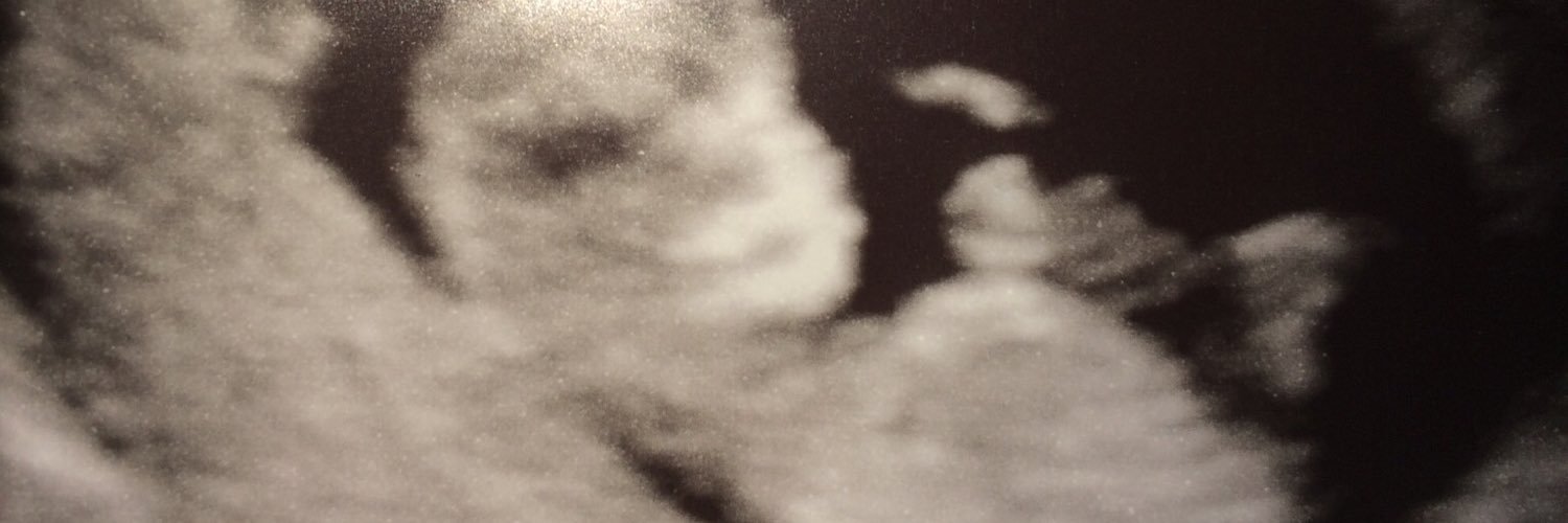 1/6/17 banner