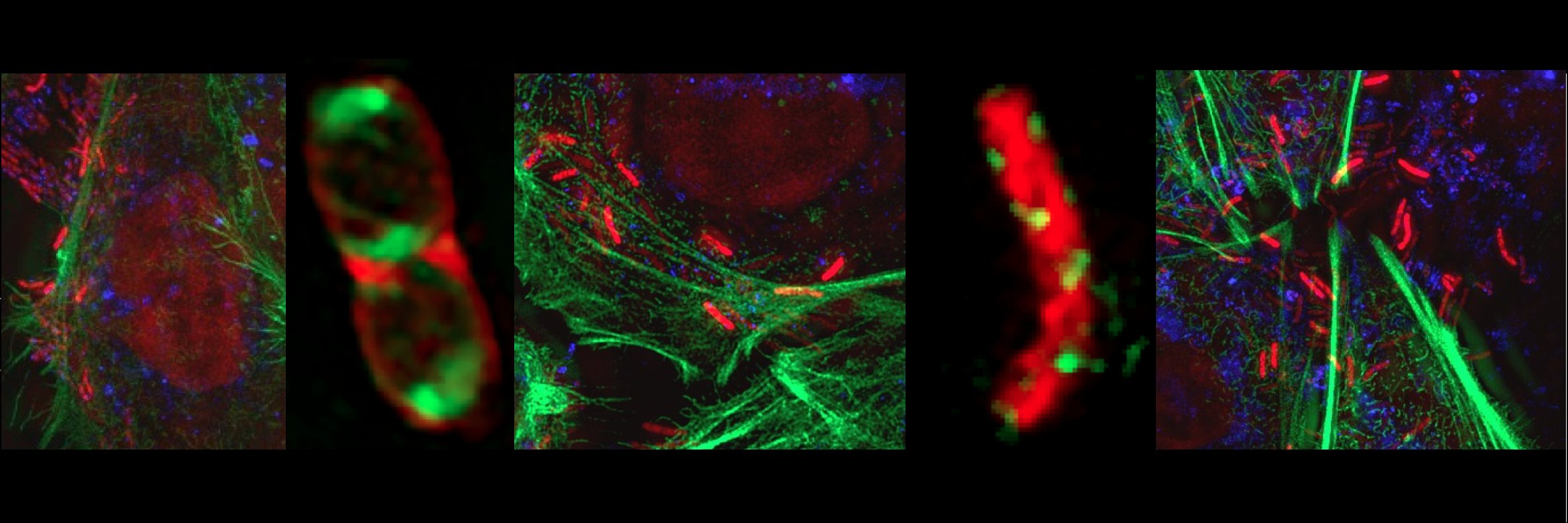 Carrie Shaffer banner