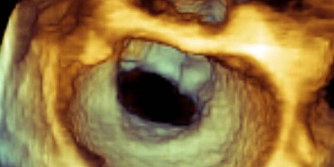 Springer Cardiology banner