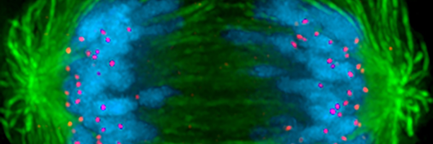 Iain Cheeseman's banner