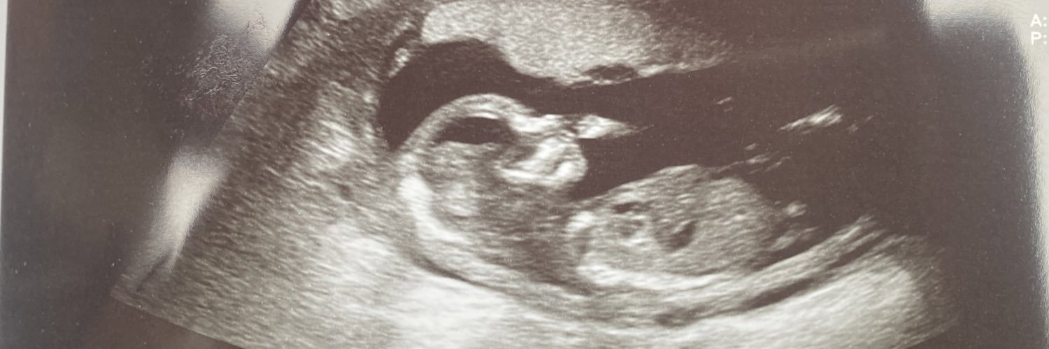 groovygabss's profile banner image