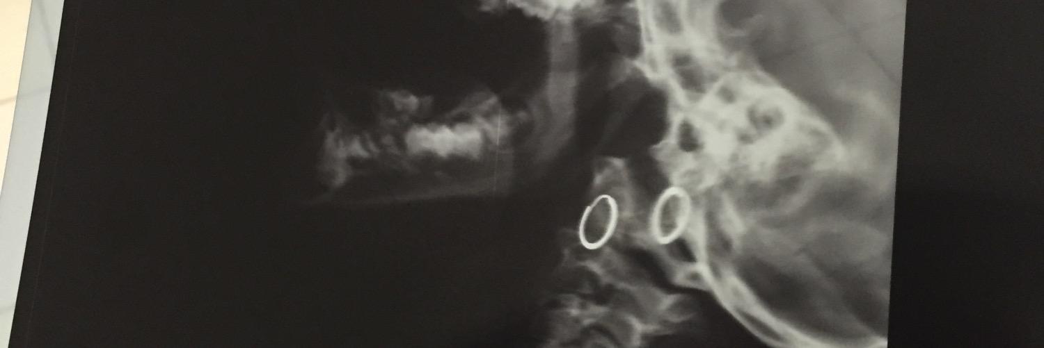 د. عمر النافل العتيبي banner