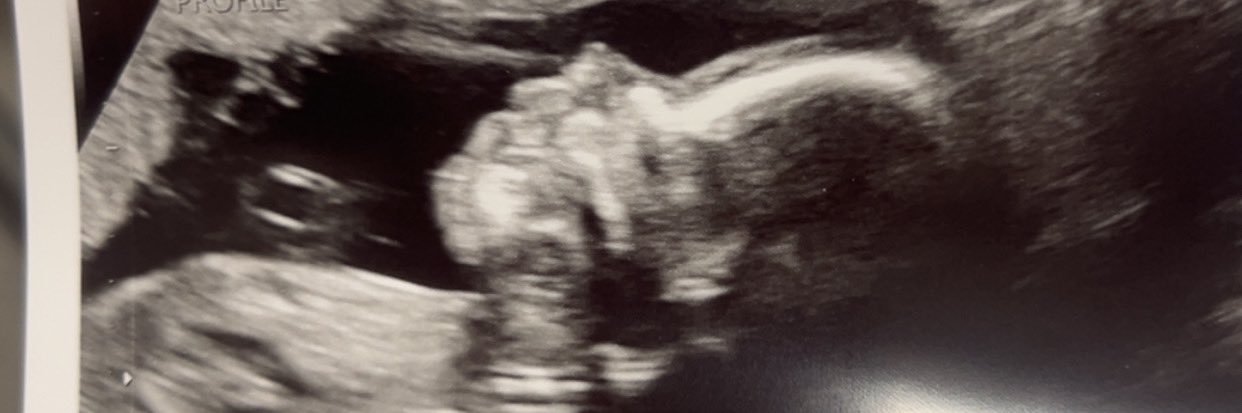 Babiejaeee's profile banner image