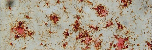 TCINeuroscience Profile Banner