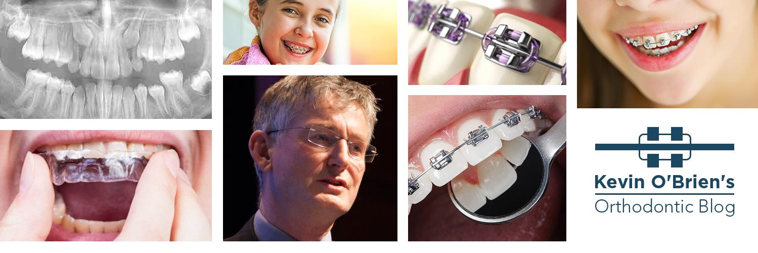 Kevin O'Brien's Orthodontic Blog banner