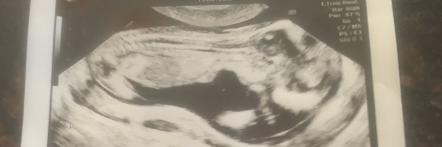 shaydeamead's profile banner image