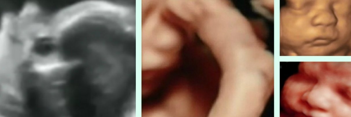 3dUltrasoundMa's profile banner image