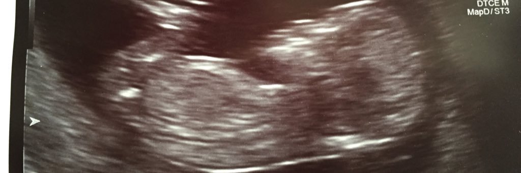 Sutdog84's profile banner image