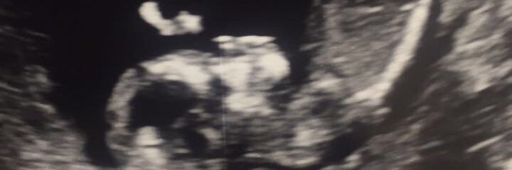 Cold__Heartedo5's profile banner image