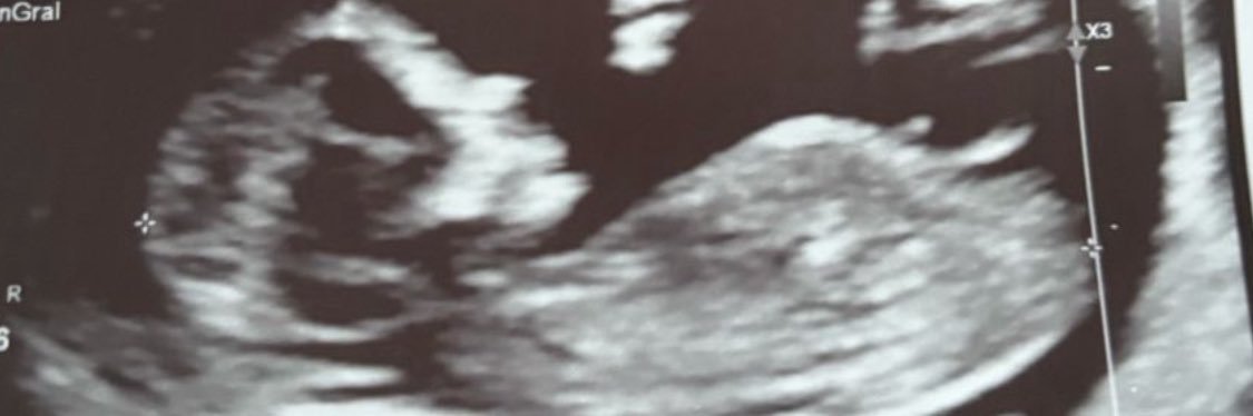 gncastano's profile banner image