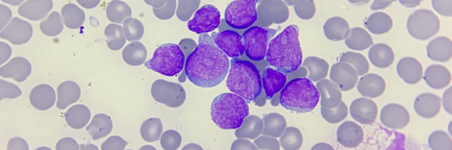 Raul Andres Verdin banner