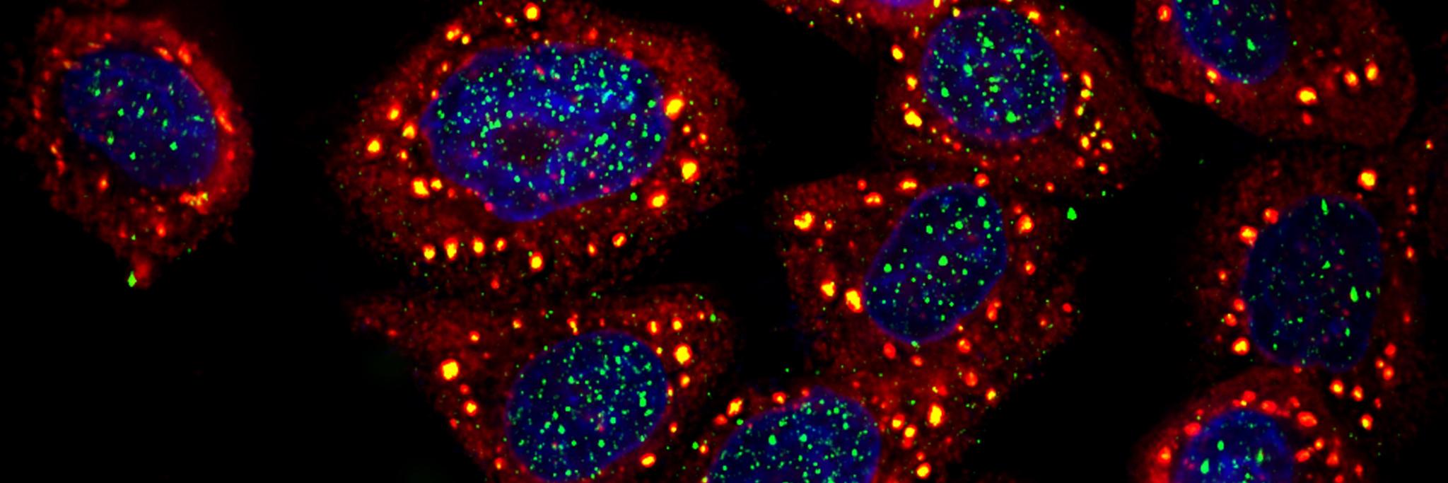 Aravinthkumar Jayabalan banner