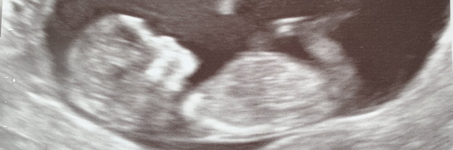 rainylewis08's profile banner image