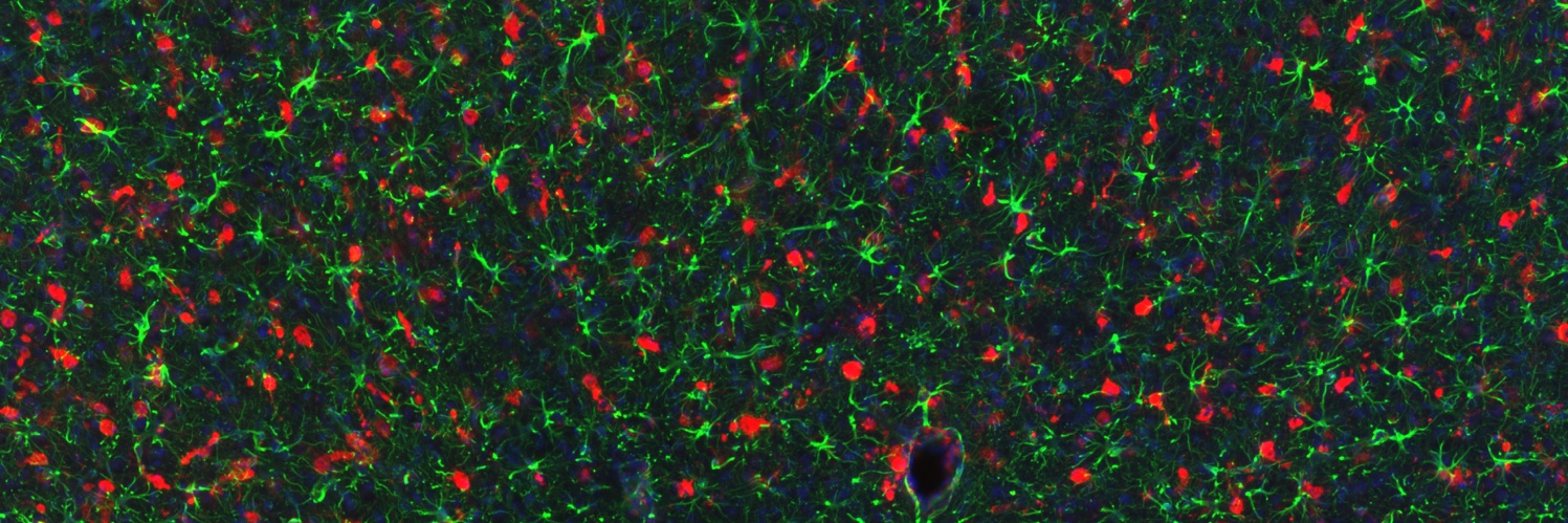 Jonathan Cooper banner