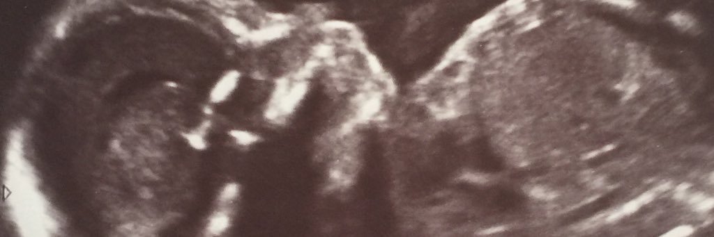 BobbieWerts's profile banner image