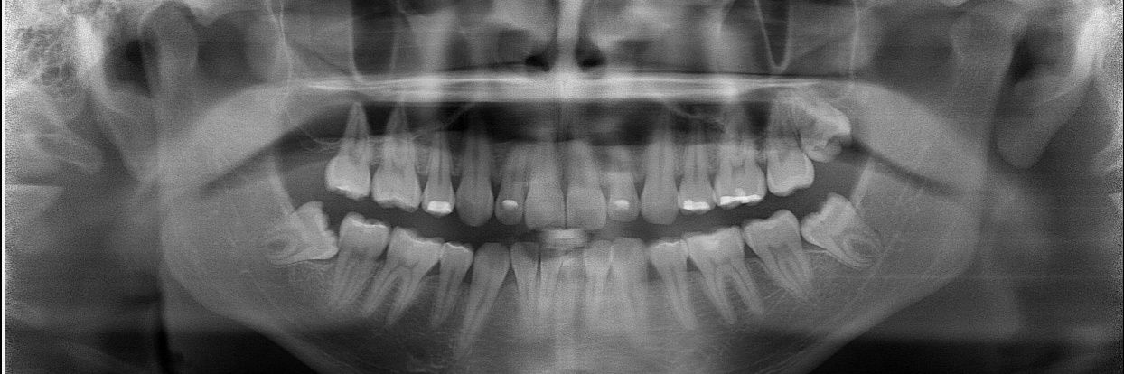 Luis Carlos Granera banner