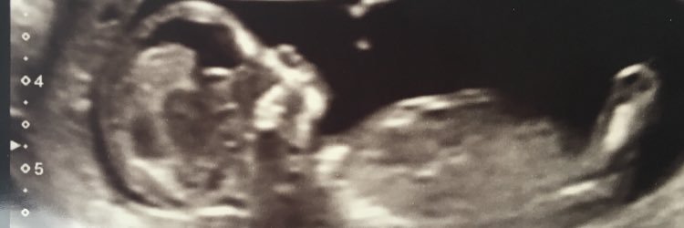 annalloyd11's profile banner image