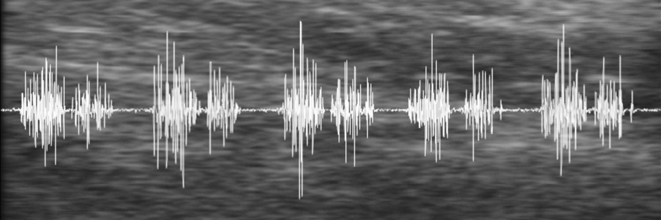 Emma Hodson-Tole (She/Her) banner