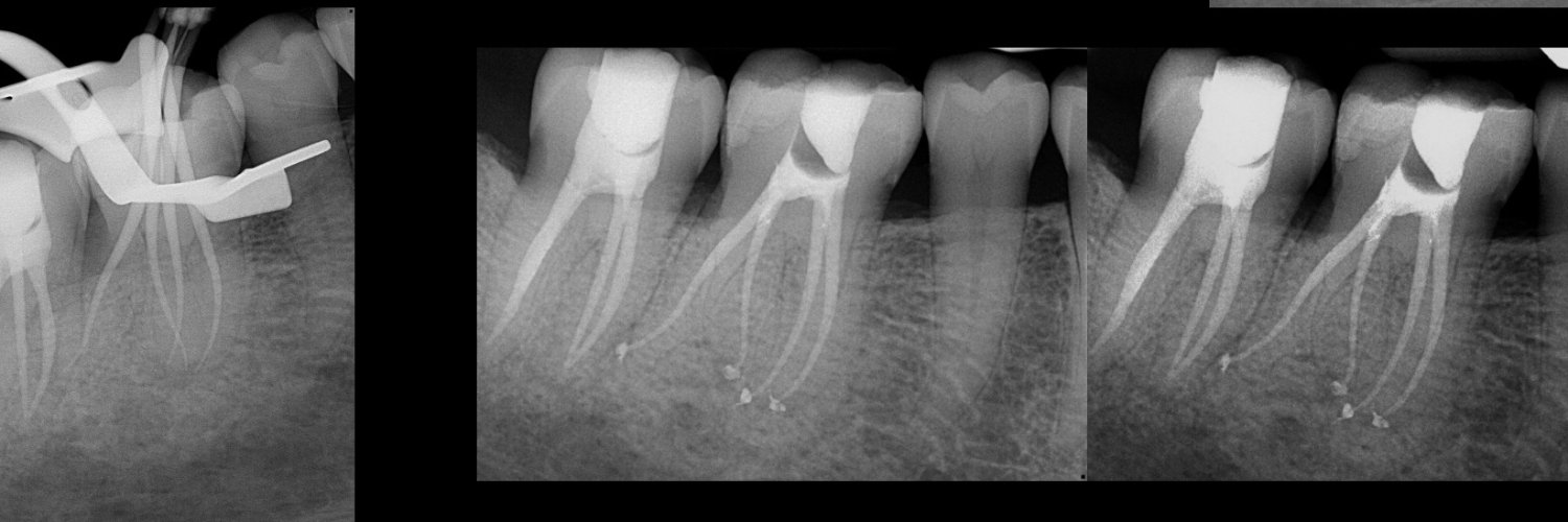 DrRootCanal banner