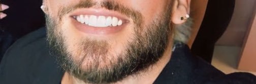 João sem pé de feijão banner