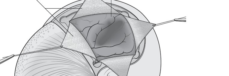 Prof Chris Uff banner