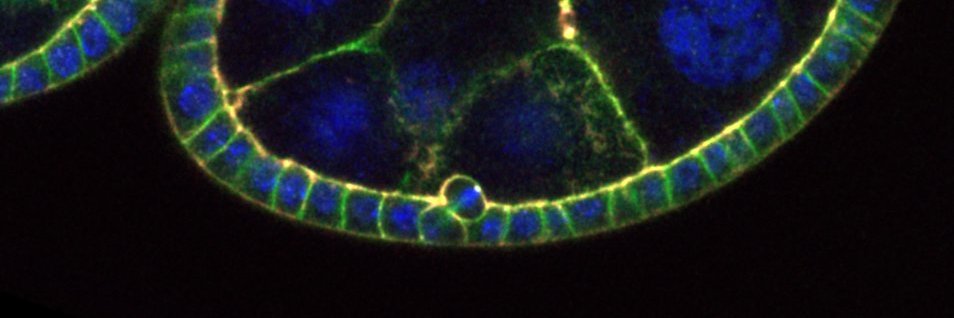 Bergstralh Lab banner