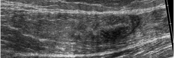 Dr_Ramon_Balius Profile Banner