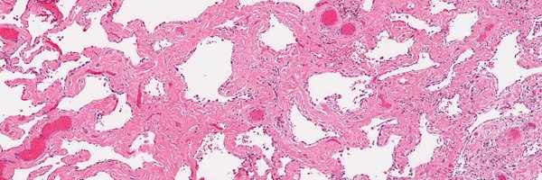 smlungpathguy Profile Banner