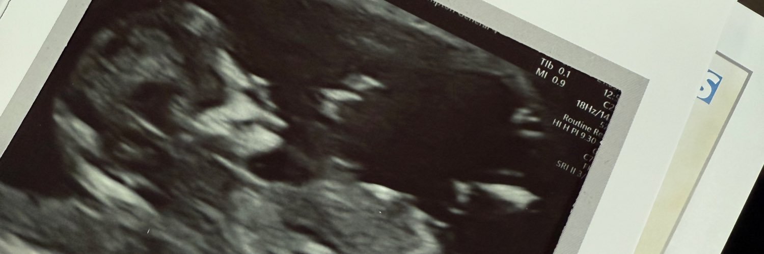 WillNFFC25's profile banner image