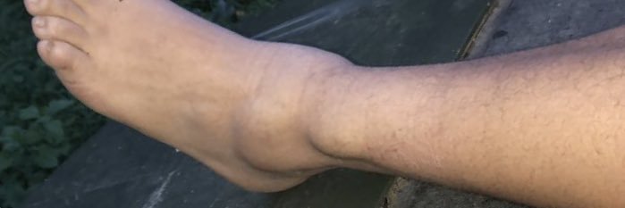 CB🕊🍏™️ banner