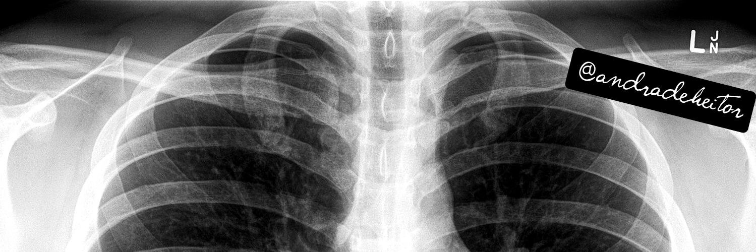 THE ALBATROSS banner