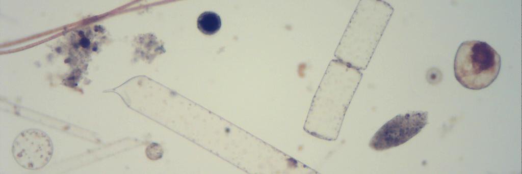 MargarethKyewalyanga banner