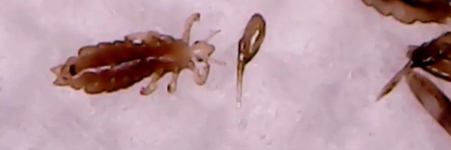 HelpForLiceIndy's profile banner image