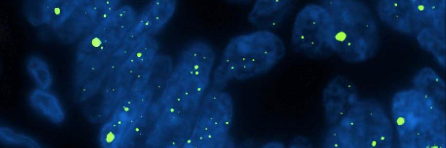 Aatur Singhi, MD PhD banner