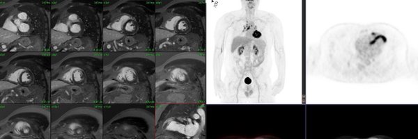 seth_uretsky Profile Banner