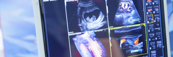 CASE_news Profile Banner