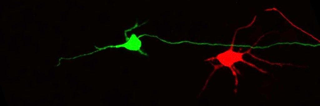 Varun Sreenivasan banner