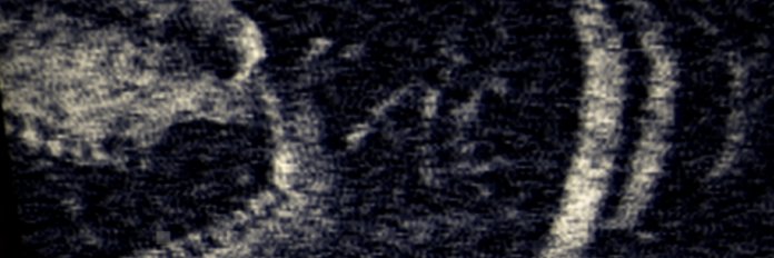 David Szymanski's banner