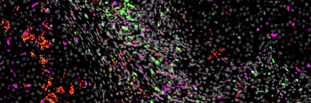 Dimitris Patseas banner