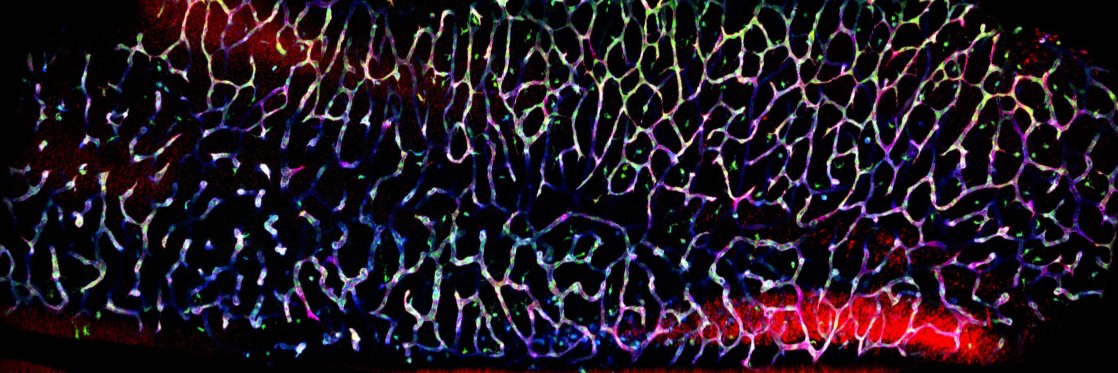 Ruhrberg lab's banner