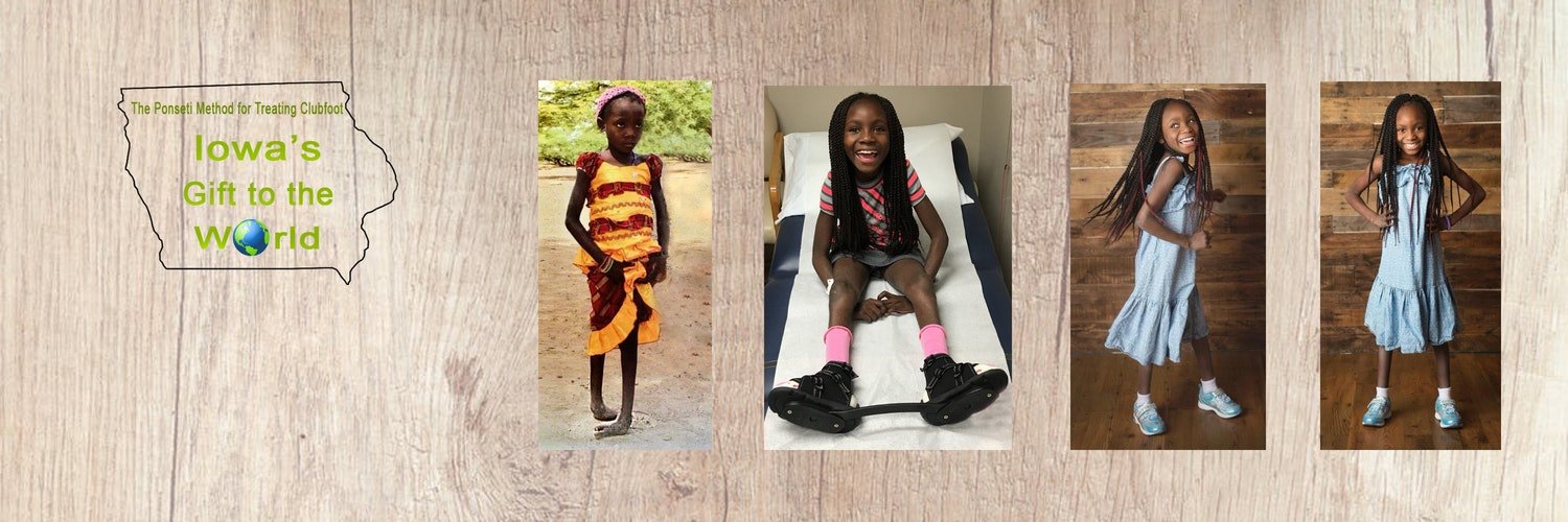 Clubfoot Solutions banner