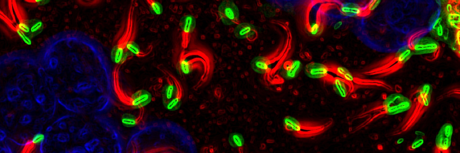 Thomas P200 Burke banner