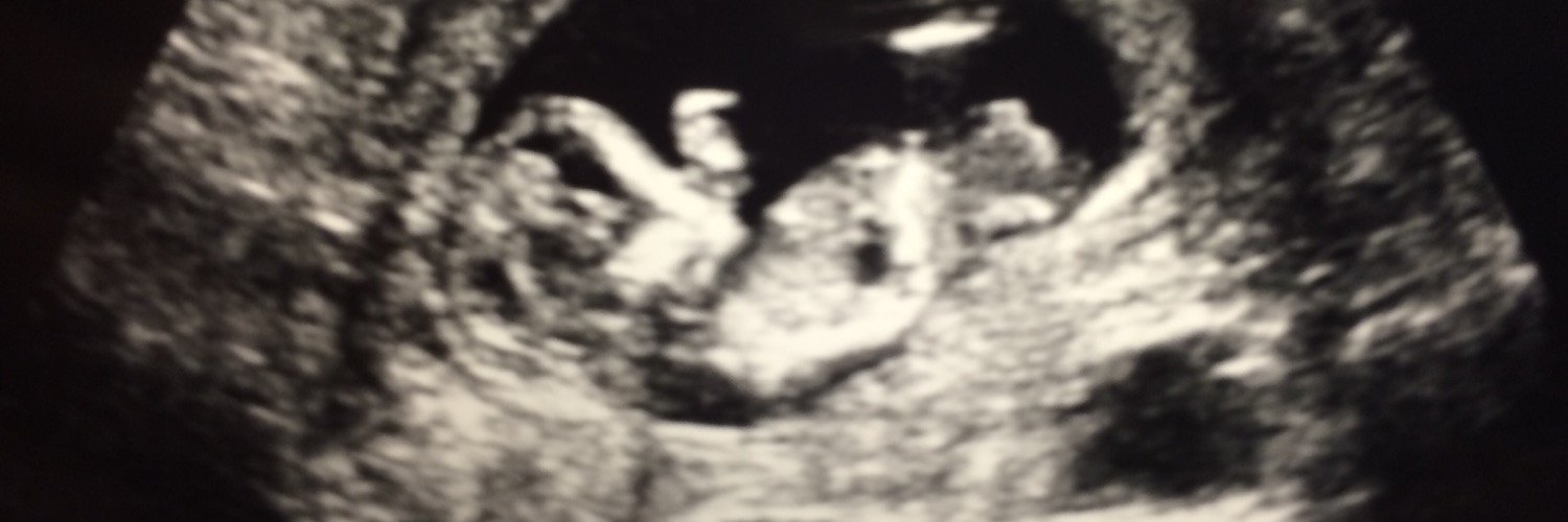 TiffNicMoz's profile banner image