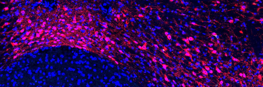 Interstellate banner