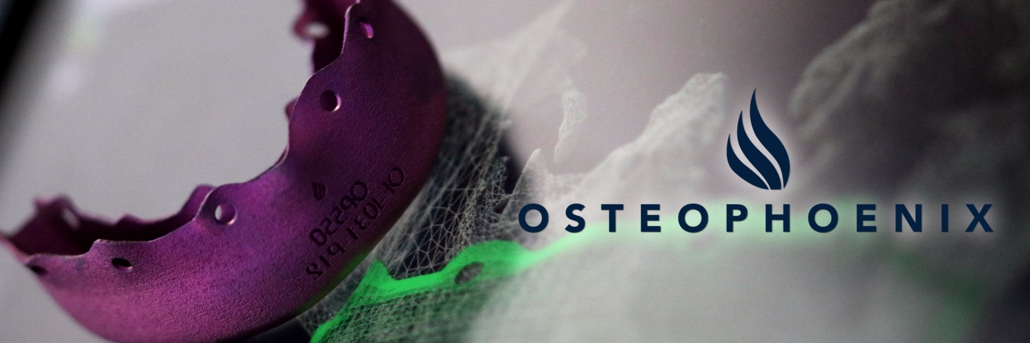 OsteophoenixSL's profile banner image