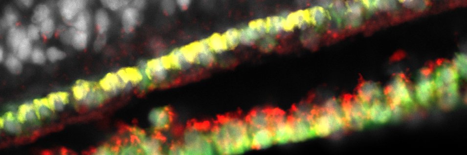 Omri Wurtzel banner