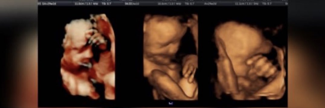 KerryyyAnnee's profile banner image