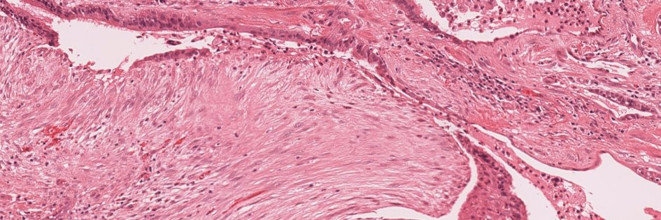 Matthew Cecchini MD PhD FRCPC banner