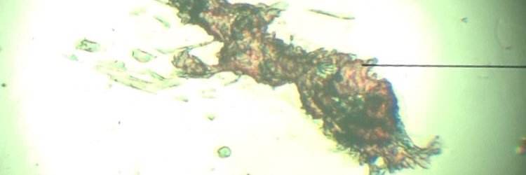 DermaLase Training banner