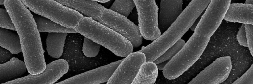 Joyce Bennett banner